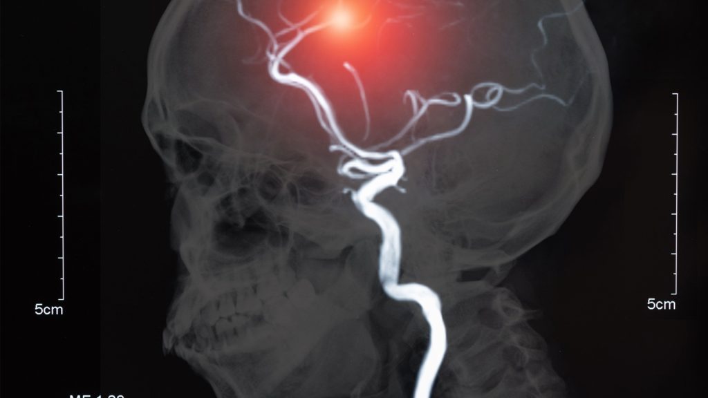 The image depicts a skull that is illuminated by a red light. The size of the skull is approximately 5cm by 5cm. This image relates to medical fields such as radiology and radiography, emphasizing the use of x-ray film in medical imaging.