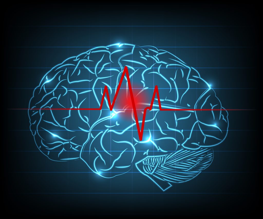 The image depicts a stylised illustration of a human brain with a superimposed red heartbeat line, suggesting a medical or neurological theme possibly related to brain activity or health.